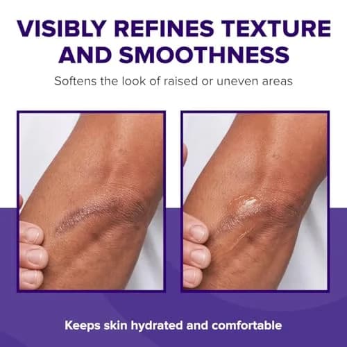 BIOCORNEUM Silisilk Silicone Scar Gel 30g (1.06 Fl Oz) | Professional-Grade Scar Refinement thumbnail 5