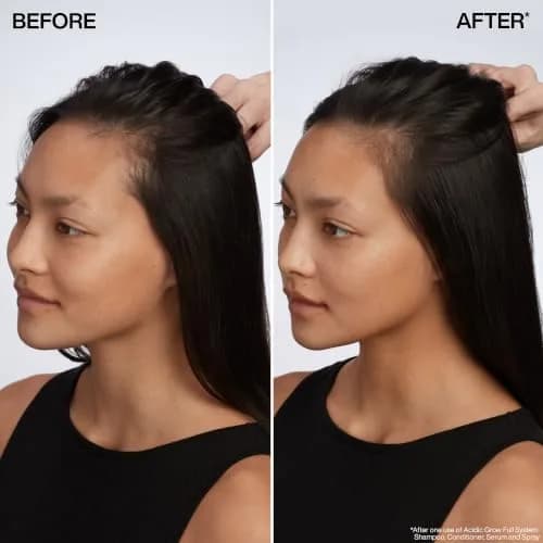 Redken Acidic Grow Full Scalp & Hair Serum – For Thicker-Looking Hair, 3.38 Fl Oz | Supports denser, thicker hair with 5% Strength Complex thumbnail 2