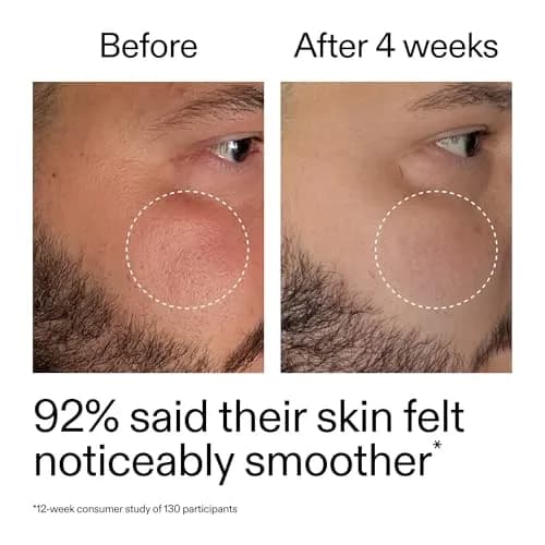 The INKEY List Starter Dual Retinol Serum 1 fl oz | Visibly Smooth Fine Lines in 7 Days thumbnail 8