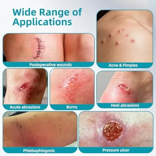 Dimora Hydrocolloid Bandages 50 Count 2" x 2" | Moist Healing Environment for Wound Recovery thumbnail 8