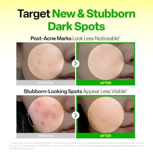 GOODAL Vitamin C Dark Spot Brightening Serum | 5% Niacinamide & Green Tangerine | Gentle Daily Facial Serum for Radiant Skin | Korean Skincare | 1.01 fl oz (30ml) thumbnail 4