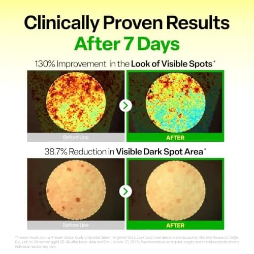 GOODAL Vitamin C Dark Spot Brightening Serum | 5% Niacinamide & Green Tangerine | Gentle Daily Facial Serum for Radiant Skin | Korean Skincare | 1.01 fl oz (30ml) thumbnail 3