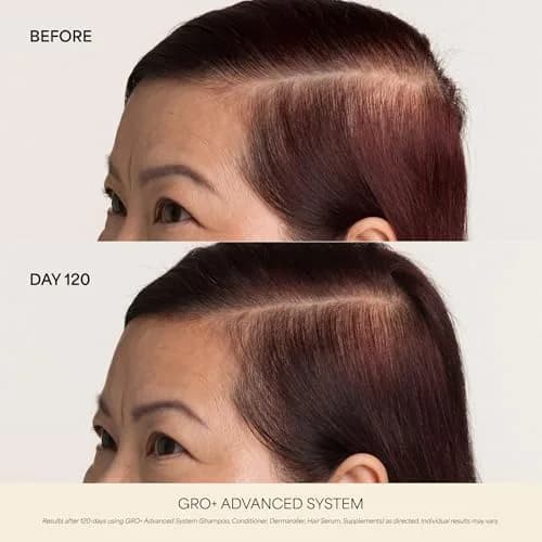 VEGAMOUR GRO+ Advanced Hair Growth Supplements - Boosts Hair Growth & Density - 30 Pill Packs/Box (Pack of 2) | Supports Thicker Hair thumbnail 3