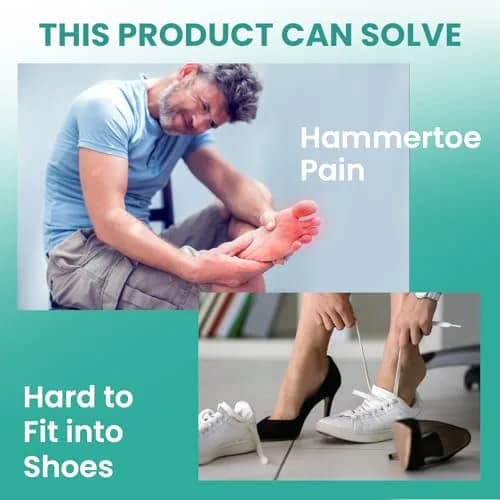 Welnove Hammertoe Corrector - 6 Pack Toe Splints - Soft Gel Toe Straighteners - Realign Bent, Curled, Crooked, Claw, Hammer Toes (Red) thumbnail 3