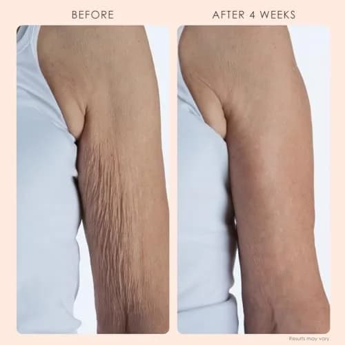 Crepe Erase Body Firm Crepe Erase Body Repair Treatment 10 oz | Anti-Aging Firming Lotion with Collagen Peptides thumbnail 3