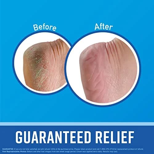 O'Keeffe's Hand & Foot Cream Pack (6.6 oz) | Repairing Skincare for Dry, Cracked Skin thumbnail 6