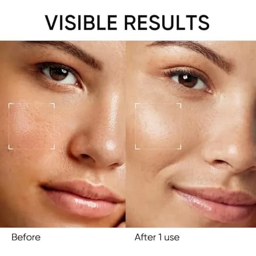 SKINTIFIC Amazonian White Clay Mask Stick 40g (1.41 oz) | Deep Pore Cleansing for Oily Skin thumbnail 4