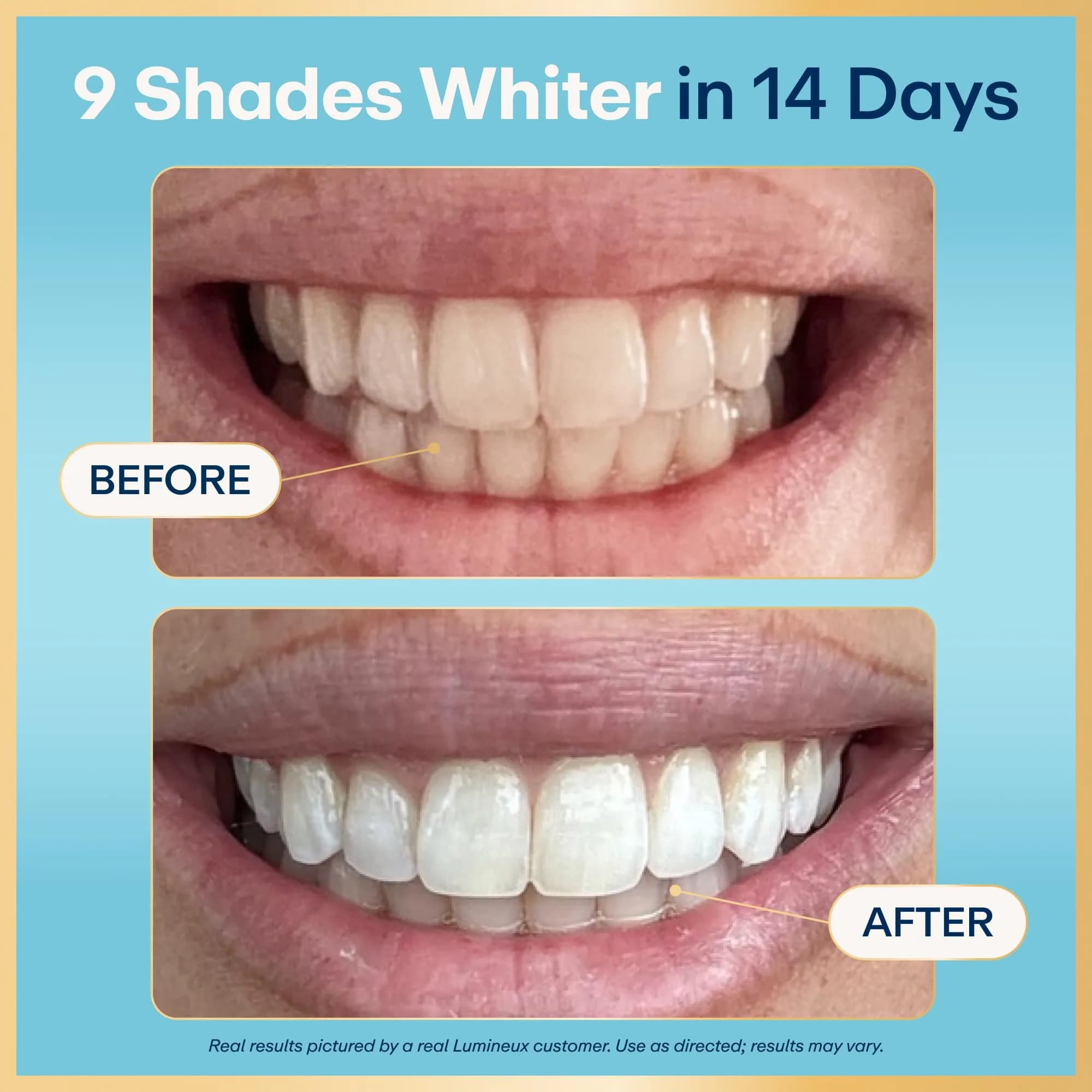 Lumineux Teeth Whitening Strips Enamel Safe Formula (863825) | Dentist-Formulated Stain Removal - view 2