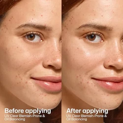 EltaMD UV Clear Blemish-Prone and Oil Balancing SPF 50 Face Sunscreen 50ml (1.7 oz) | Broad Spectrum Protection thumbnail 5
