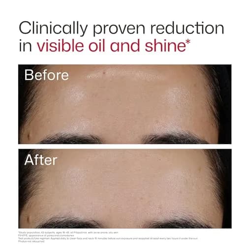 EltaMD UV Clear Blemish-Prone and Oil Balancing SPF 50 Face Sunscreen 50ml (1.7 oz) | Broad Spectrum Protection thumbnail 7