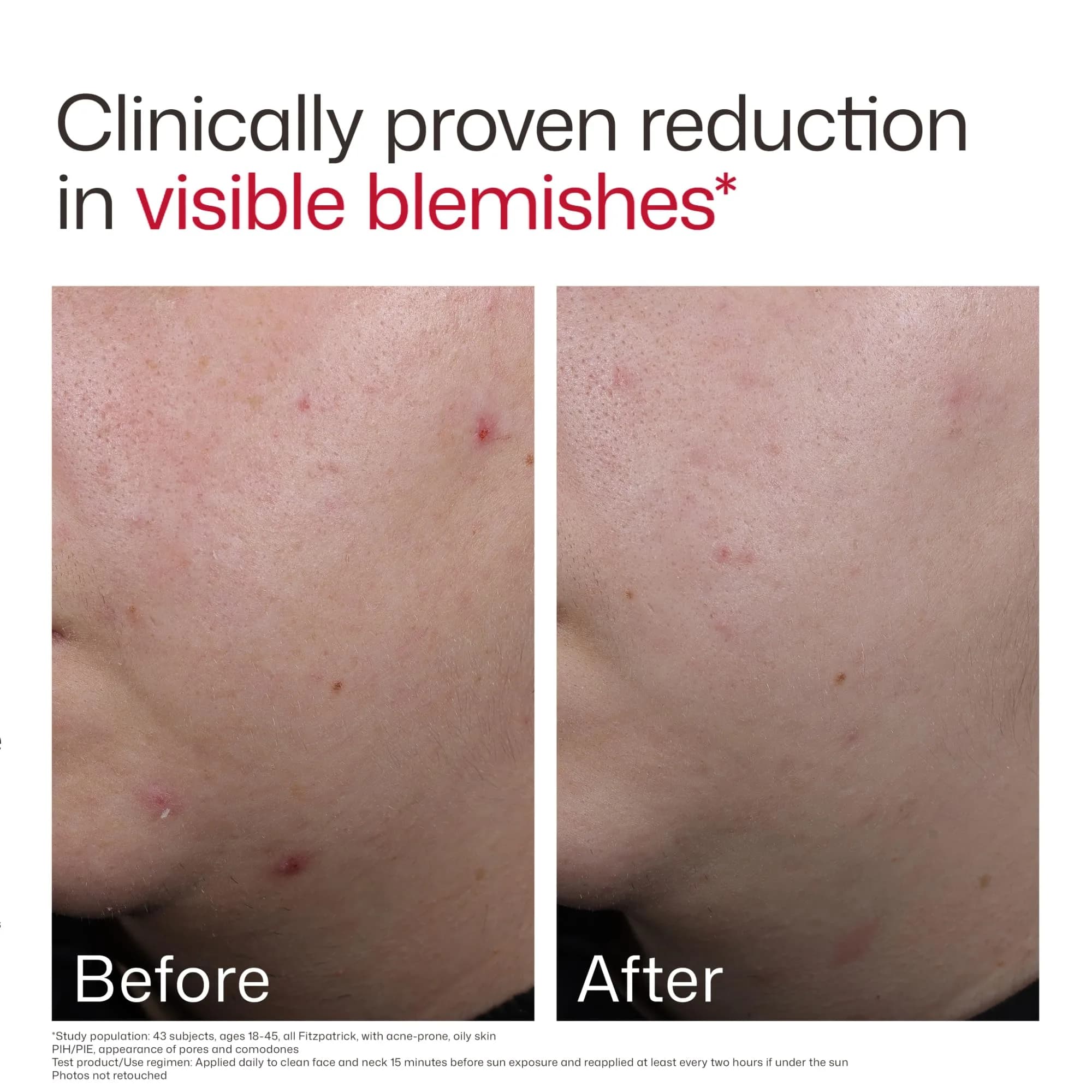 EltaMD UV Clear Blemish-Prone & Oil Balancing SPF 50 Sunscreen, Non-Comedogenic, 48g (1.7 oz) - view 6