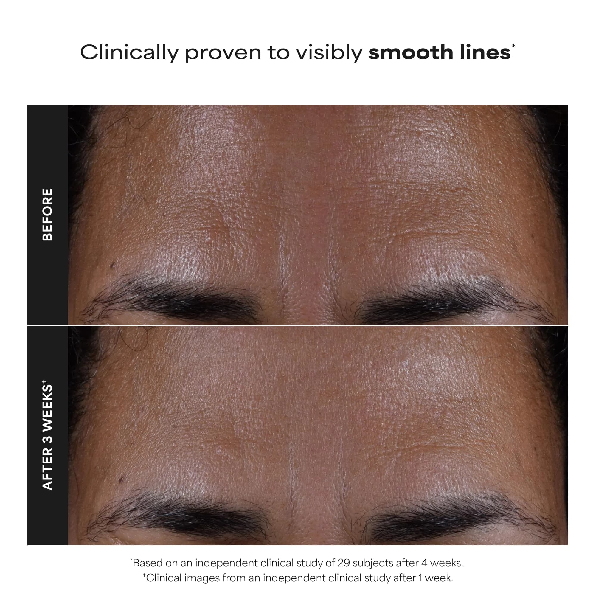 Paula's Choice SKIN PERFECTING 2% BHA Liquid Salicylic Acid Exfoliant 236ml (8 Fl Oz) | Gentle Non-Abrasive Leave-On Exfoliant - view 2