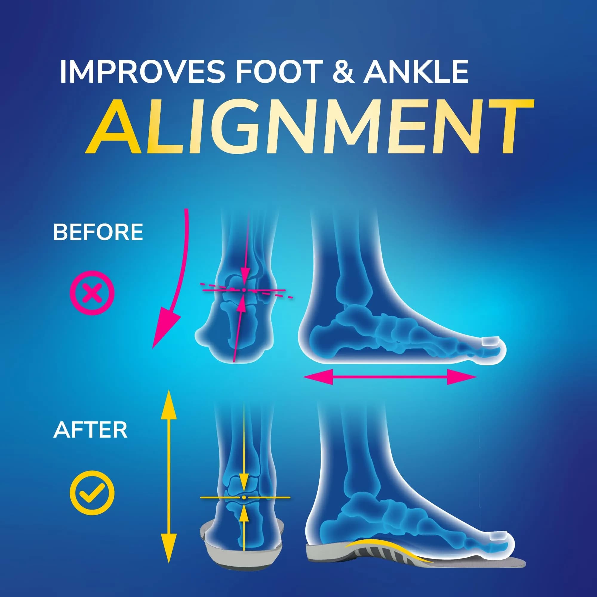 Dr. Scholl's Flat Feet Support Insoles for Men, Size 8-14 (12-Pack) | FDA Approved Arch Support for Overpronation - view 2