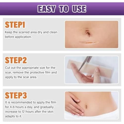 PSECICI Silicone Scar Sheets Medical Grade Tape for Old & New Scars 3M (1.6" x 120") | Advanced Scar Treatment thumbnail 7