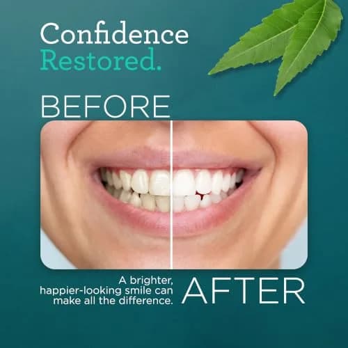 GuruNanda Hydroxyapatite Toothpaste with Neem & Vitamins 16.8oz (2x4.2oz) | Dentist-Recommended for Enamel Health thumbnail 8