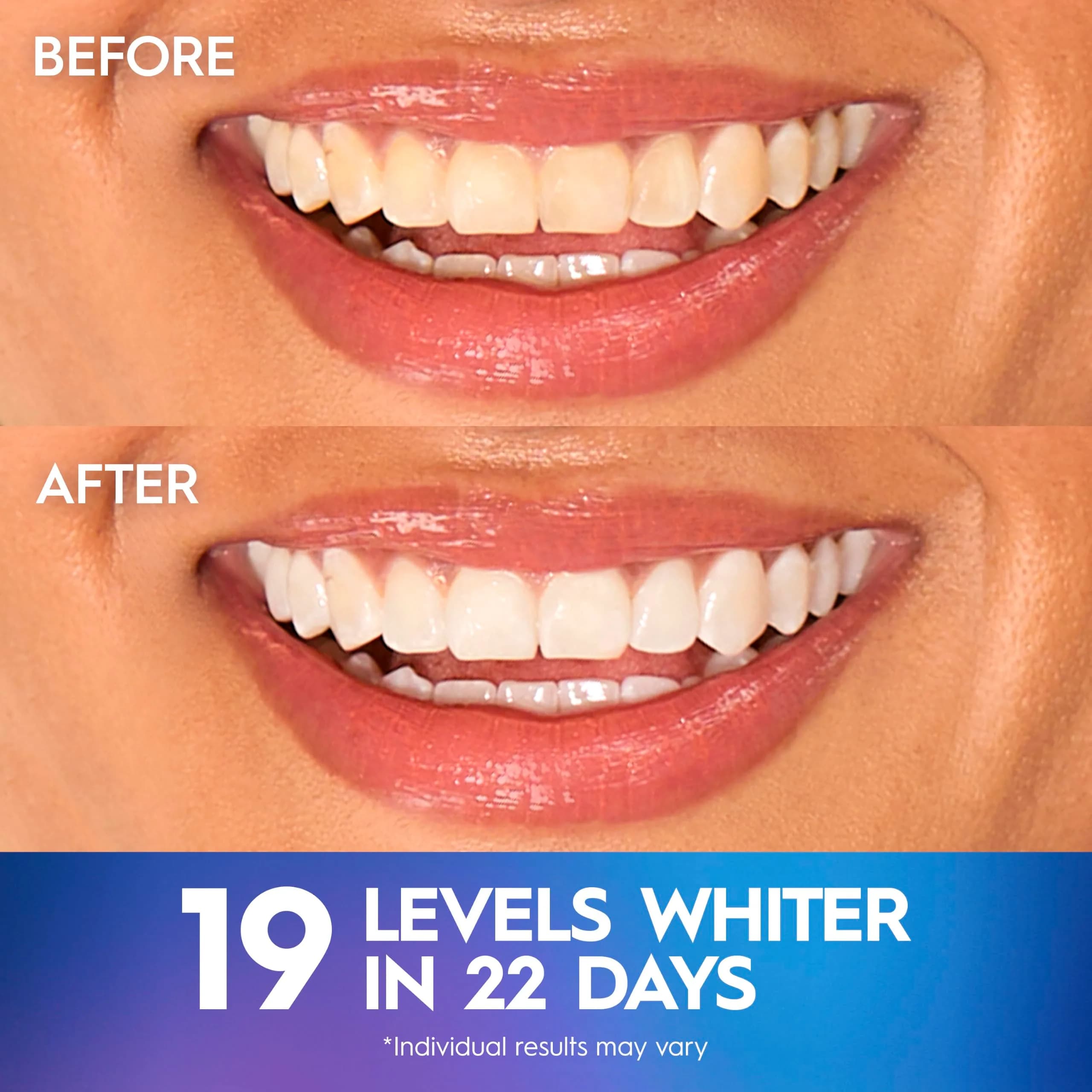 Crest 3D Whitestrips Professional Effects Teeth Whitening Kit - 20 Treatments - view 4