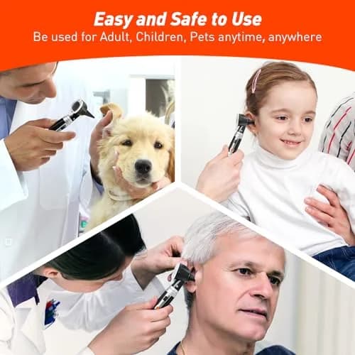 Scian Otoscope - Ear Scope with Light, Fiber Optic Otoscopes with Hard Plastic Case, Pocket Ear Infection Detector for Nurses,Kids,Elders,Home Use (Black) | Clear Ear Observation thumbnail 2