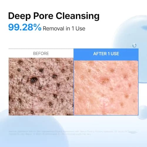 MANYO Azulene Hyaluronic 2X Serum Oil Cleanser 200ml (6.76 fl oz) | Calms Skin, Deep Cleans Pores thumbnail 7