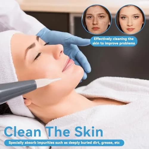 Agatige Blackhead Removal Glass Tube Kit (Pack of 3) | Vacuum Suction Pore Cleaner Accessories thumbnail 3