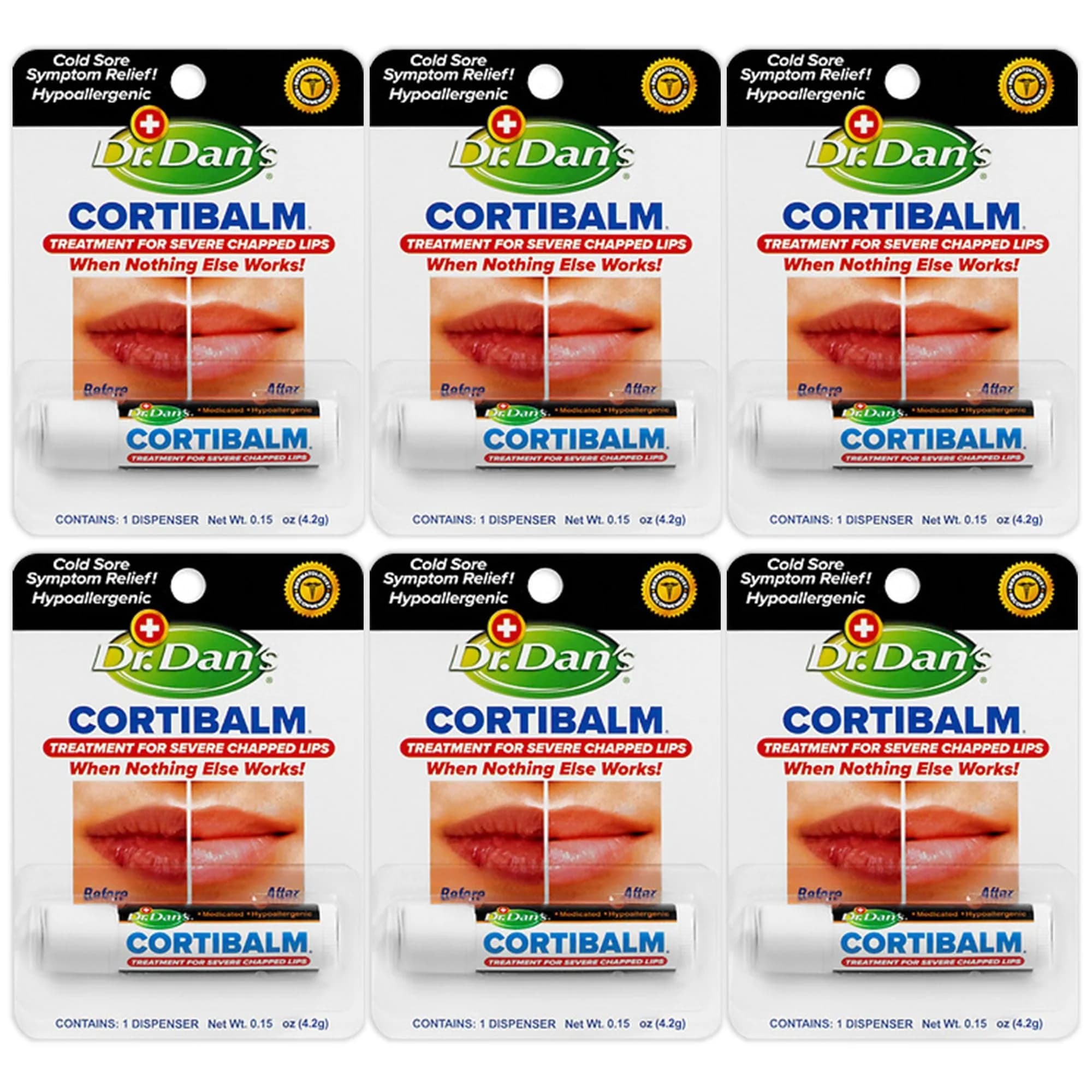 Dr. Dan's Cortibalm 6-Pack Healing Lip Balm for Chapped Dry & Cracked Lips | Hydrocortisone & Beeswax