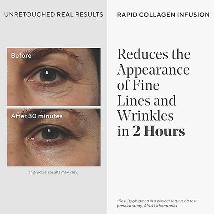 Murad Rapid Collagen Infusion - Resurgence Anti-Aging for Face - Skin Smoothing Cream Targets Deep Wrinkles - Gentle Skin Treatment Backed by Science, 1.0 Oz
