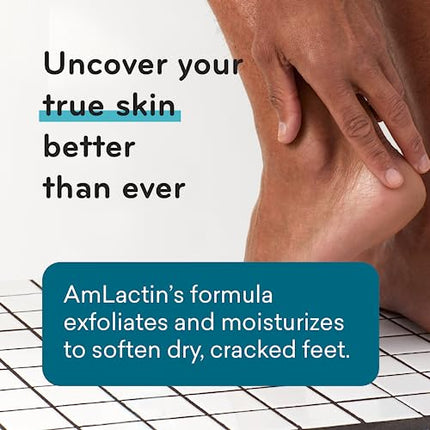 AmLactin Foot Repair Cream - 3 oz Foot Cream for Dry Cracked Heels with 15% Lactic Acid - Exfoliator and Moisturizer for Dry Skin & Foot Care (Packaging May Vary)