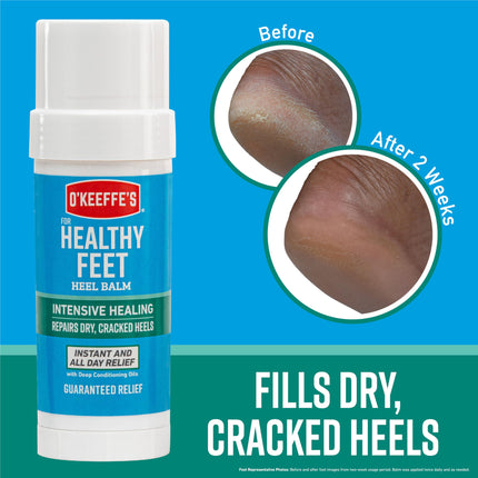 O'Keeffe's for Healthy Feet Intensive Healing Balm, Guaranteed Relief for Extremely Dry, Cracked Feet, Heel Balm that Instantly Fills Dry, Cracked Heels, 2.2oz Balm Stick, (Pack of 1)