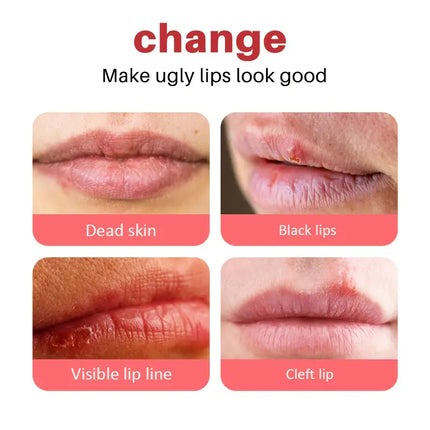 Lip Treatment for Dark Lips