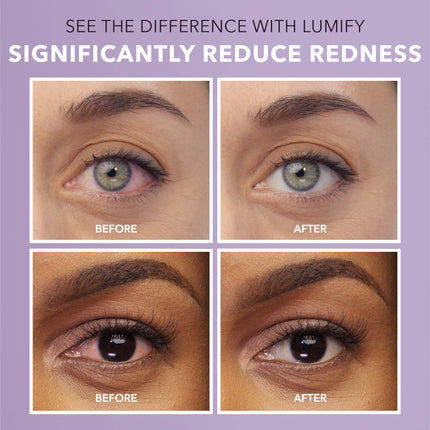 Buy LUMIFY Redness Reliever Eye Drops 0.25 Ounce (7.5mL) in India India