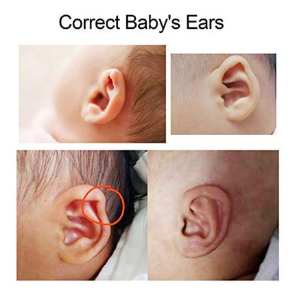 Buy Baby Auricle Valgus Correction Patch, Newborn Baby Ear Aesthetic Correctors Kids Infant Protruding in India